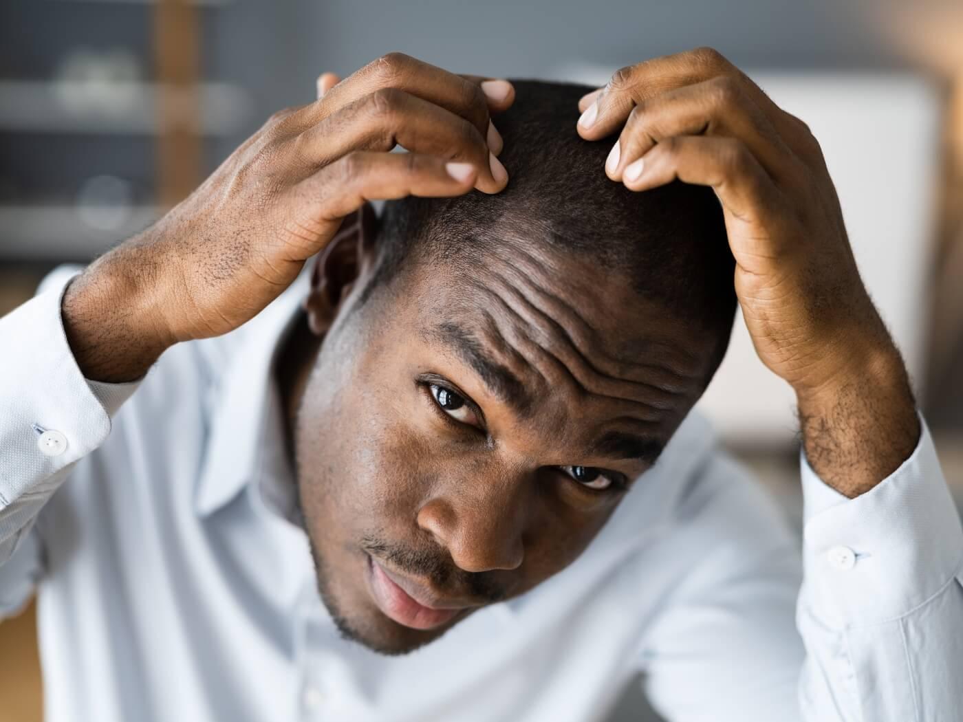 5 Essential Oils for Boosting Hair Growth and Thickness in Men - OBRO