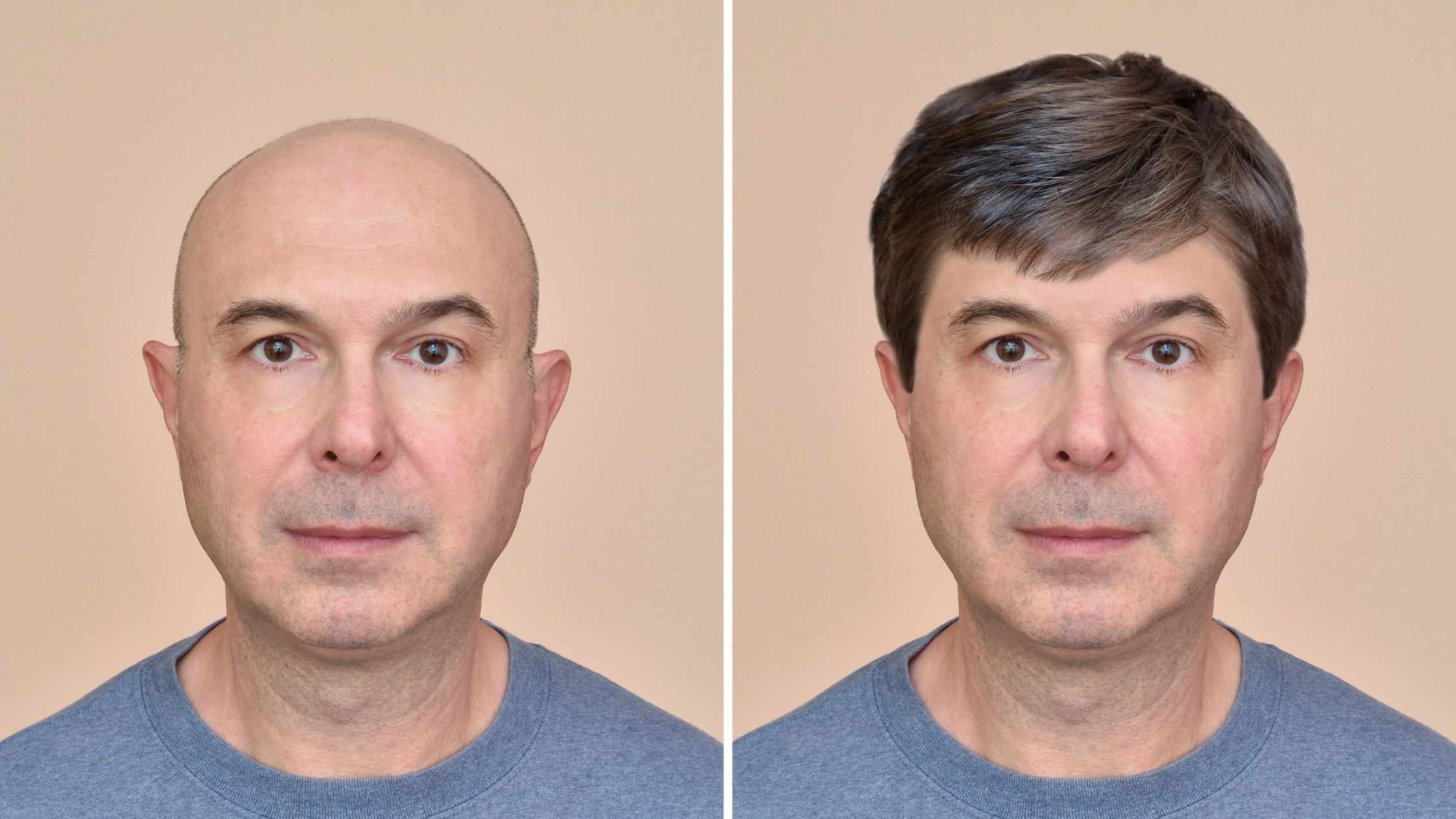 Top 7 Effective Oils for Alopecia: Promoting Healthy Hair Growth