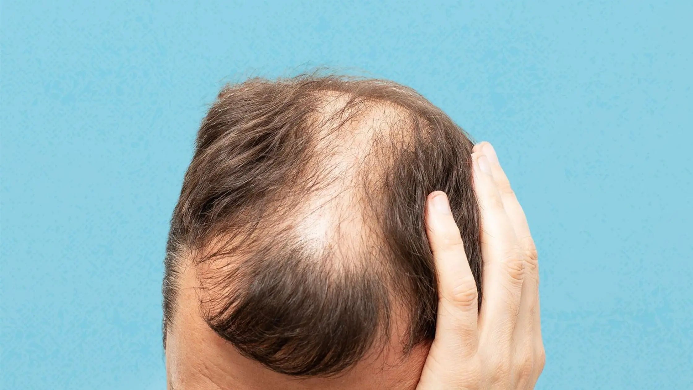 Discover the Best Natural Hair Loss Remedy: Revitalize Your Locks