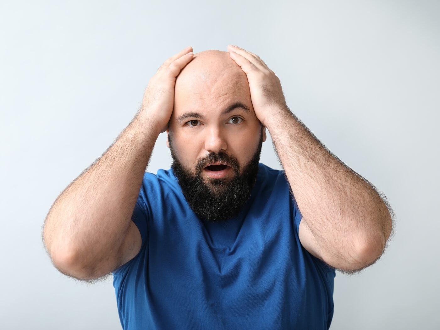 Looking for Ways to Combat Thinning Hair? Try These 8 Tips for Men - OBRO