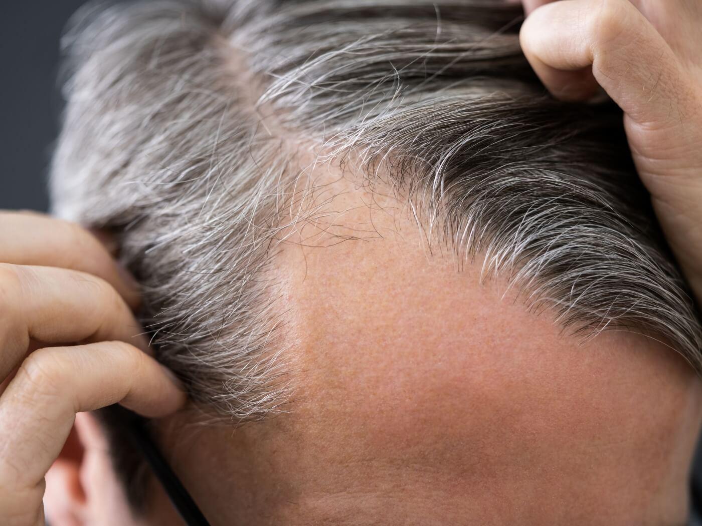 Natural Ways to Regrow Thinning Hair - OBRO