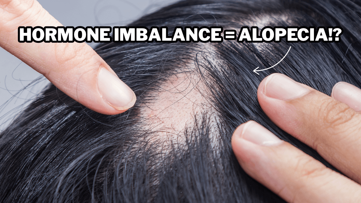 What is Alopecia and Male Pattern Baldness?