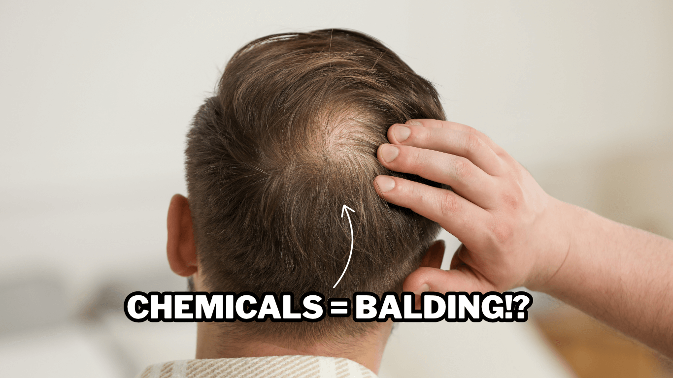 What Causes Male Balding