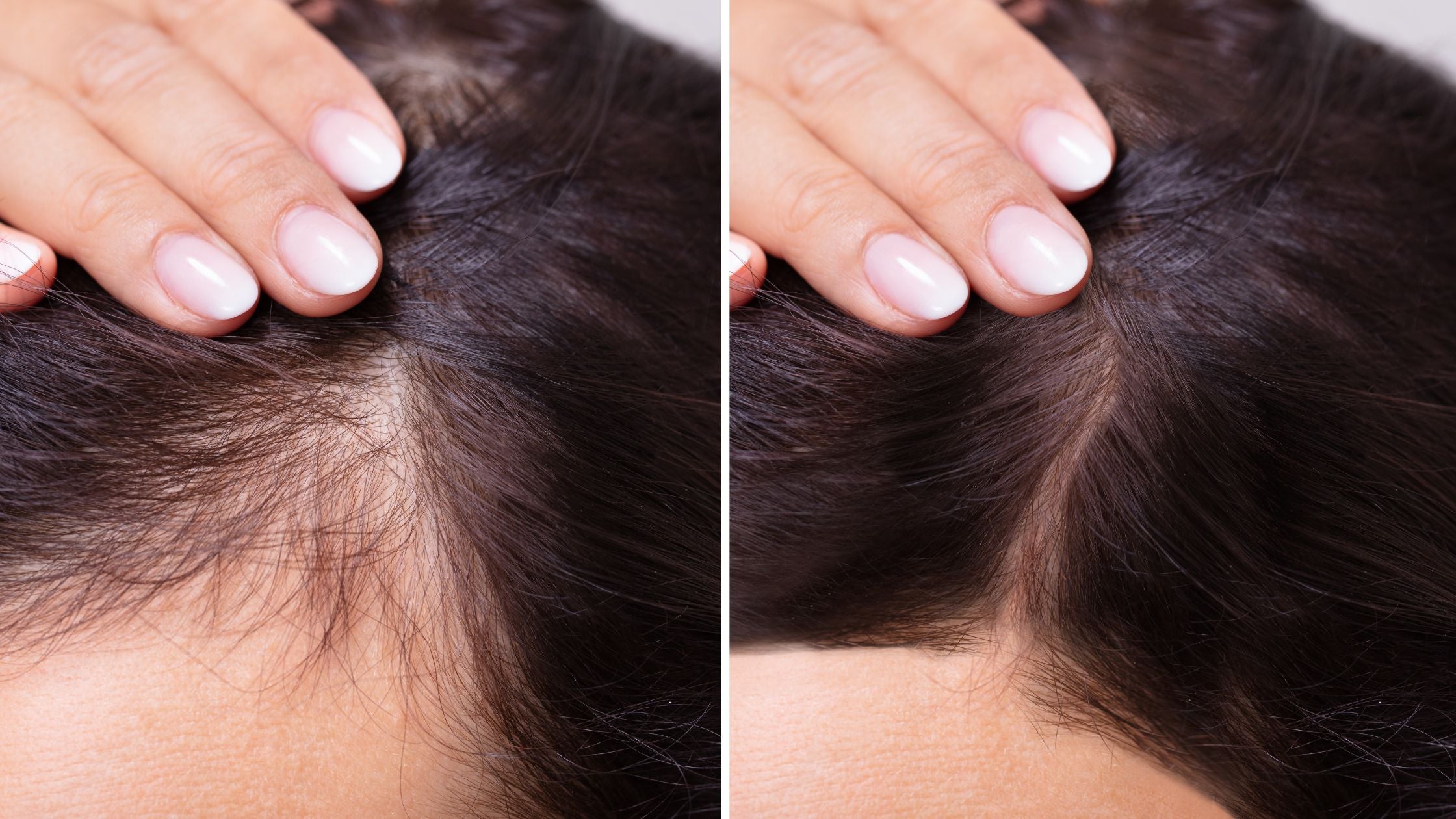 Top 10 Natural Remedies to Combat Thinning Hair